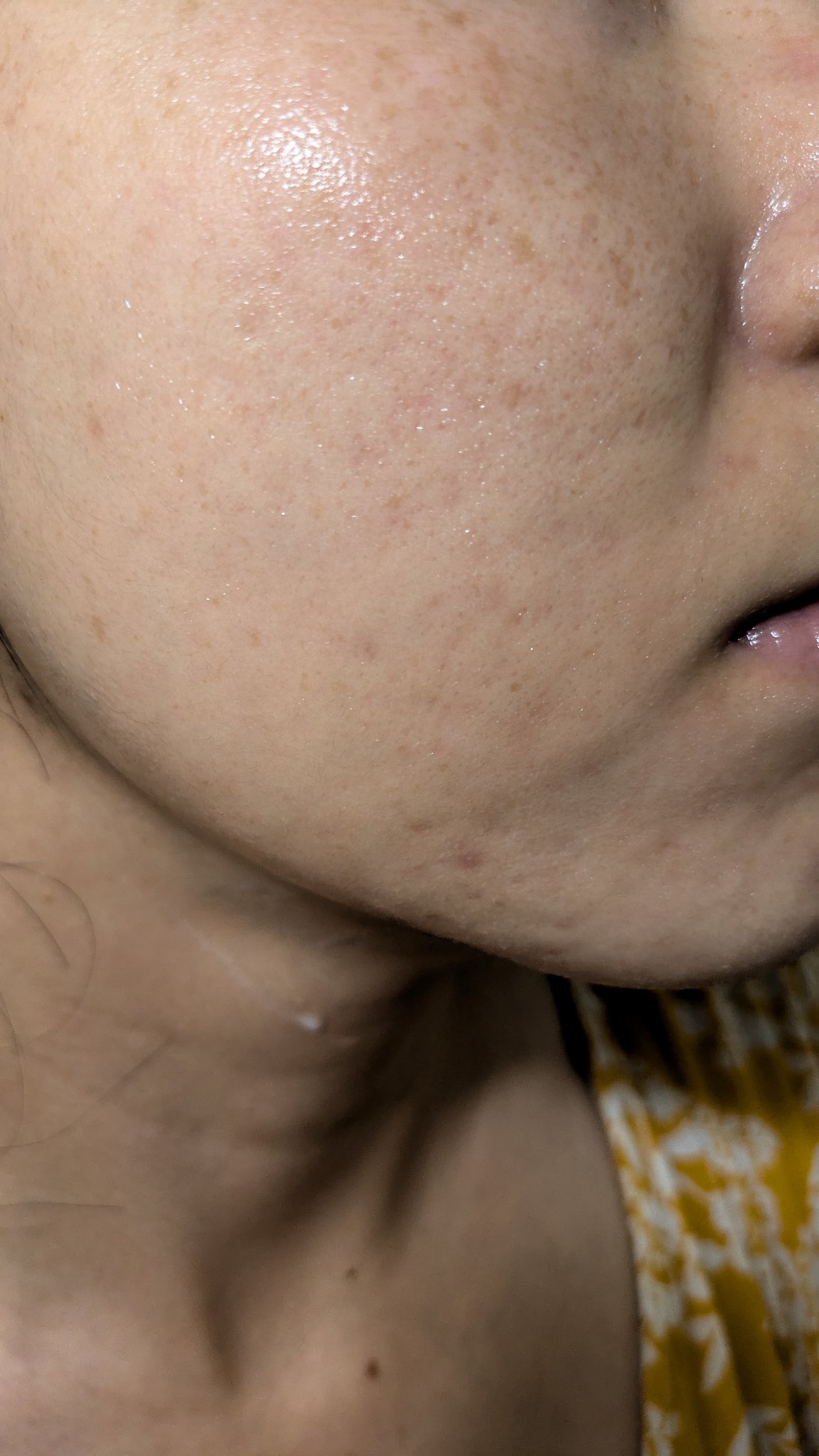 薬用リンクルナイトクリーム ホワイト/なめらか本舗/フェイスクリームを使ったクチコミ（1枚目）