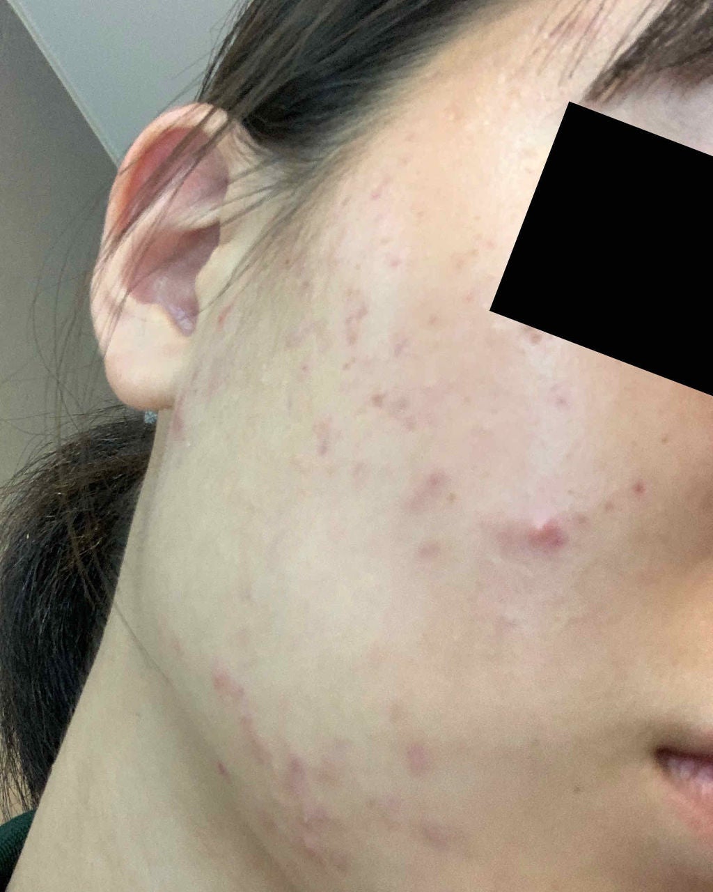 kanna on LIPS 「※2枚目、3枚目に汚い写真があります!!気をつけてください!助..」(3枚目)