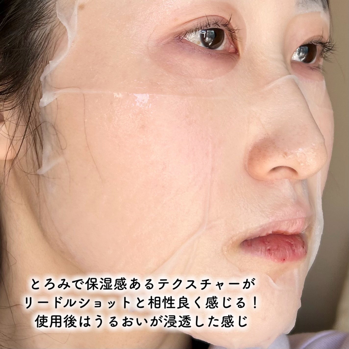 リードルS 100 2ステップマスク/VT/シートマスク・パックを使ったクチコミ(6枚目)