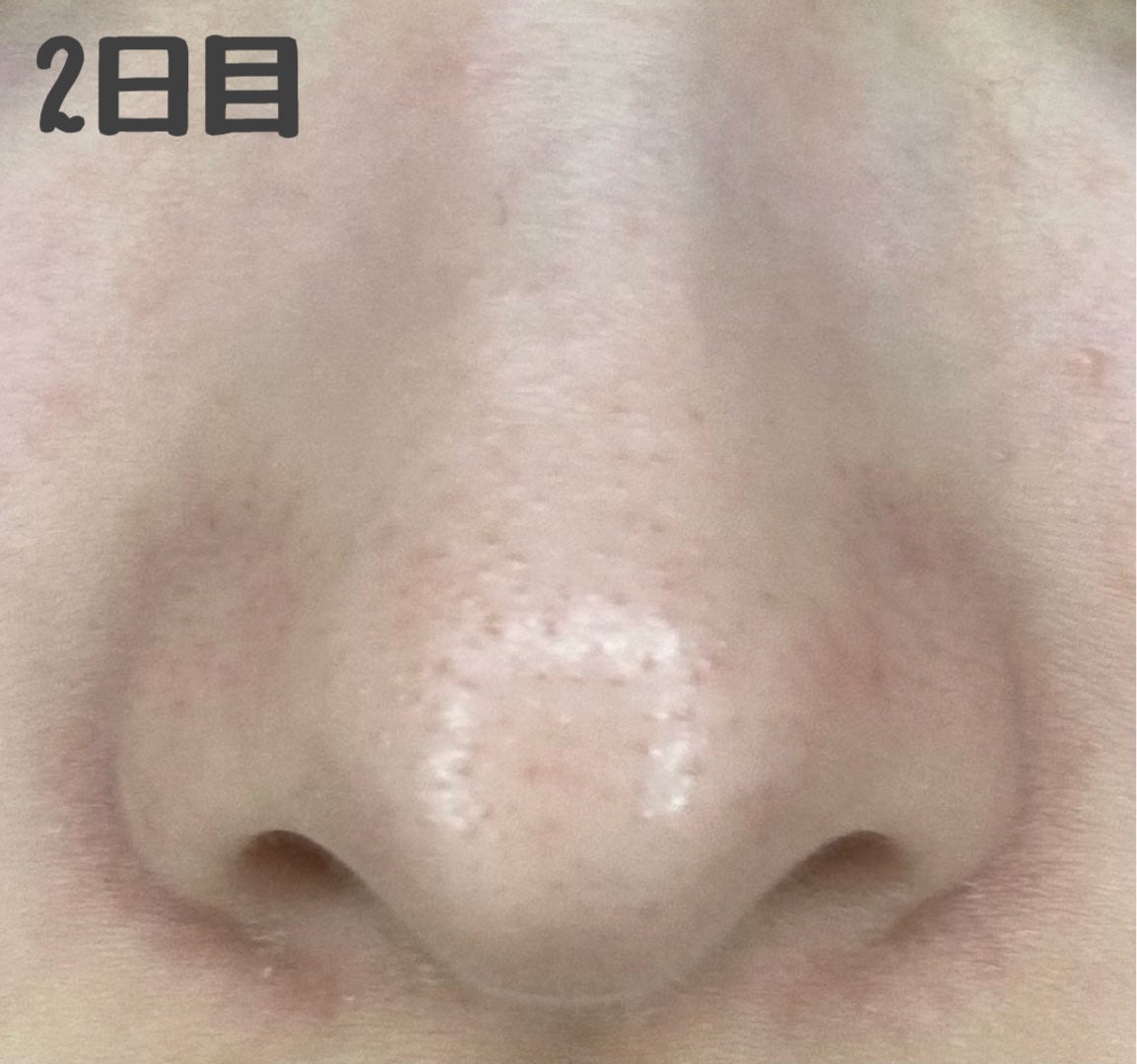 デュオ ザ クレンジングバーム ブラックリペア /DUO/クレンジングバームを使ったクチコミ(3枚目)