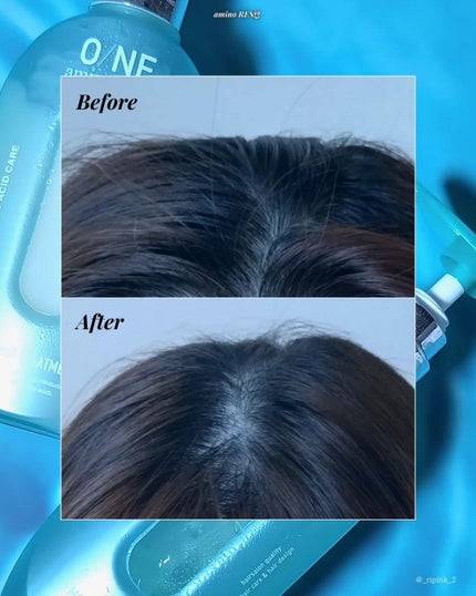 ワン アミノレスキューモイストシャンプー/トリートメント/アミノレスキュー/市販シャンプーを使ったクチコミ(5枚目)