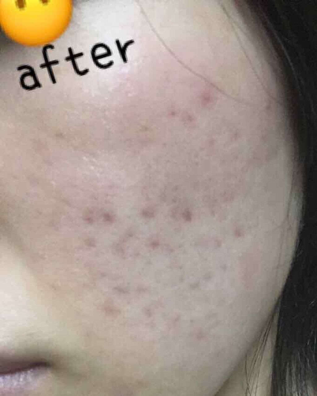 薬用 クリアローション M(しっとりタイプ)/オルビス/化粧水を使ったクチコミ（3枚目）