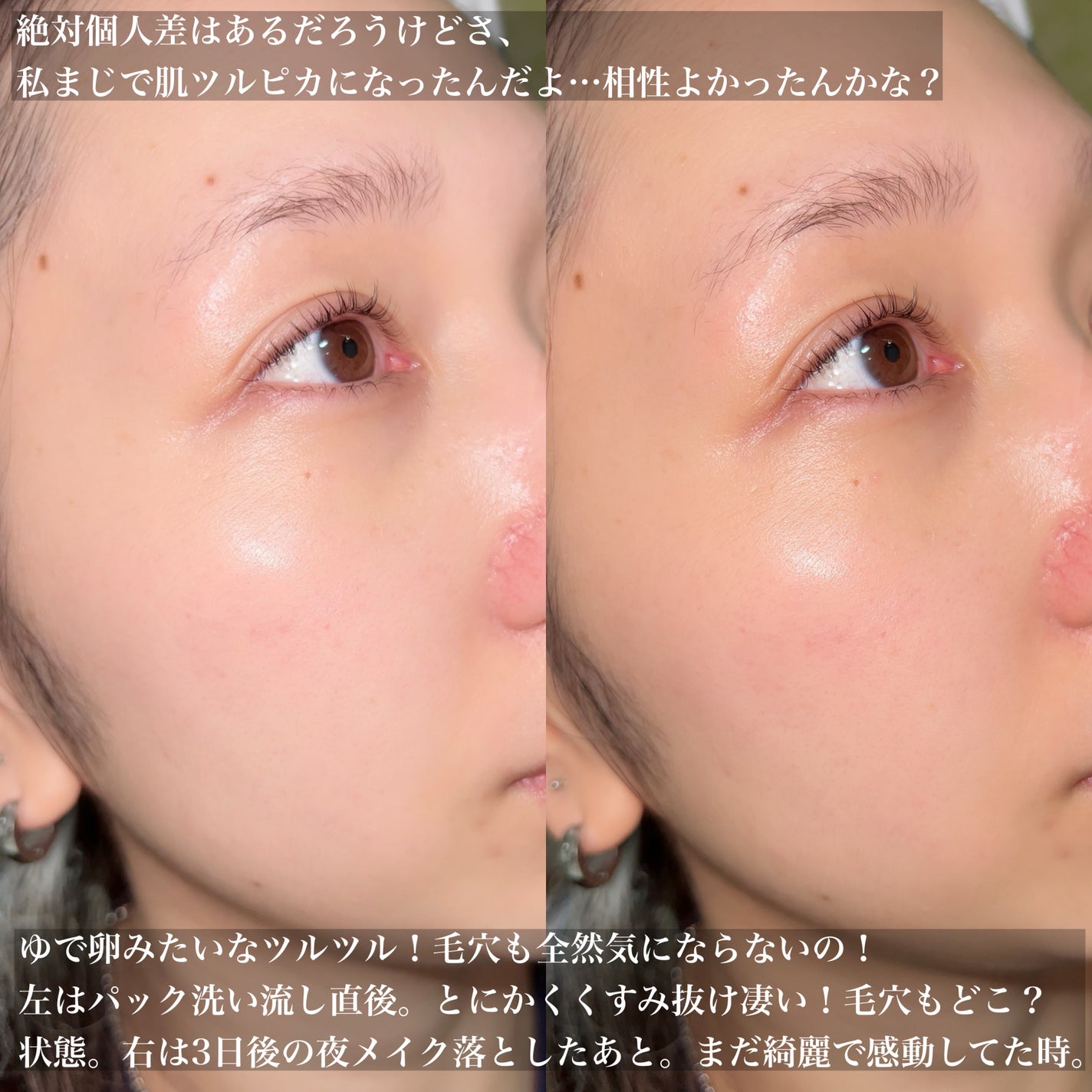 ゼロ毛穴クレイパック/MEDICUBE/洗い流すパック・マスクを使ったクチコミ(3枚目)
