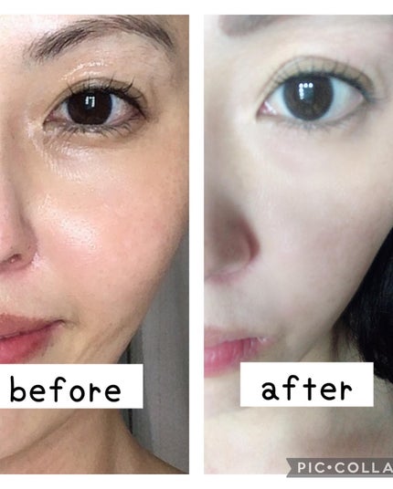 リードルショット300/VT/美容液を使ったクチコミ(5枚目)