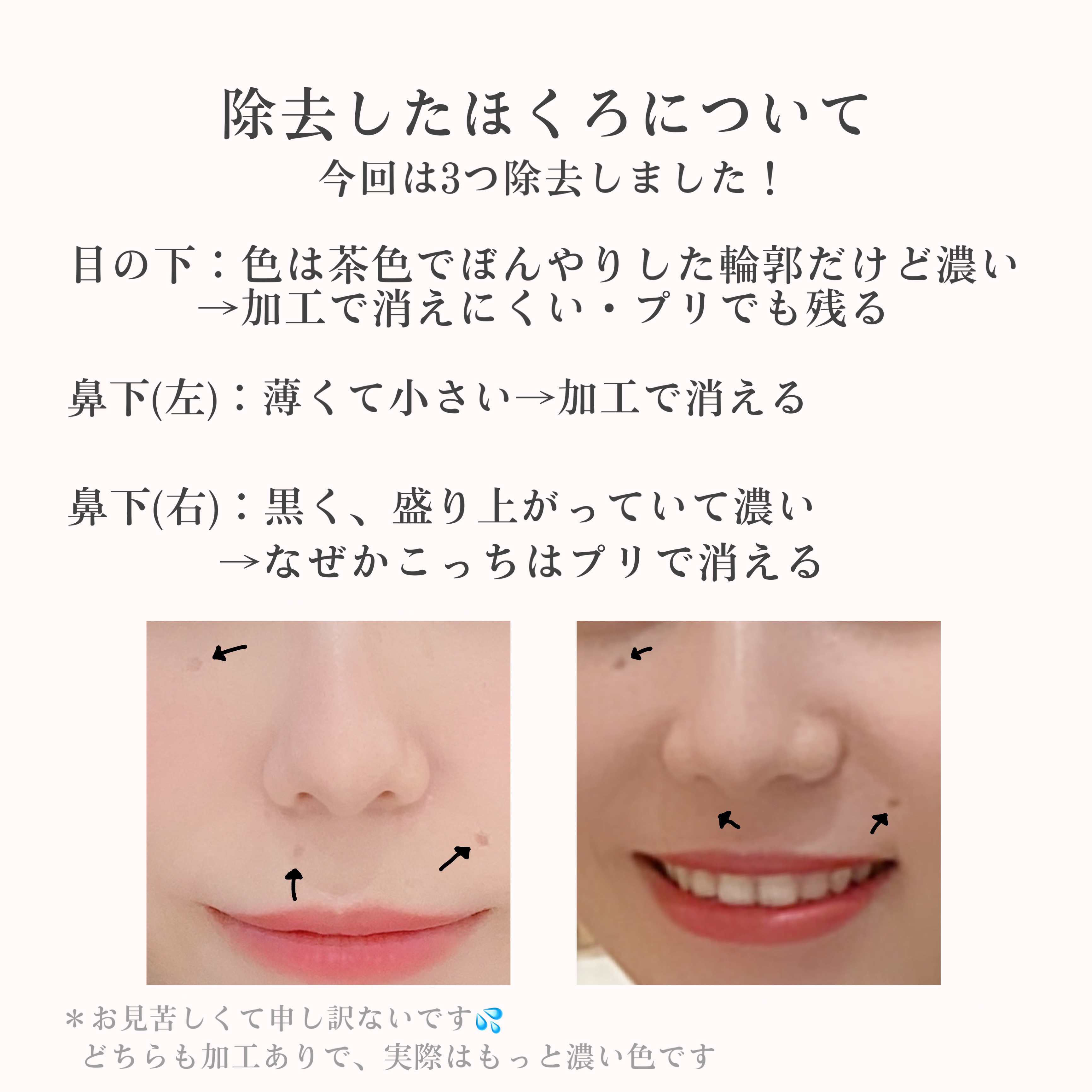 白潤プレミアム 薬用浸透美白乳液/肌ラボ/乳液を使ったクチコミ（2枚目）