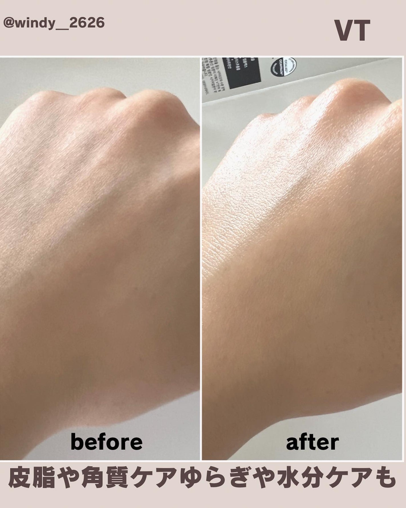 リードルショットシナジースパークリングトナー/VT/化粧水を使ったクチコミ(7枚目)