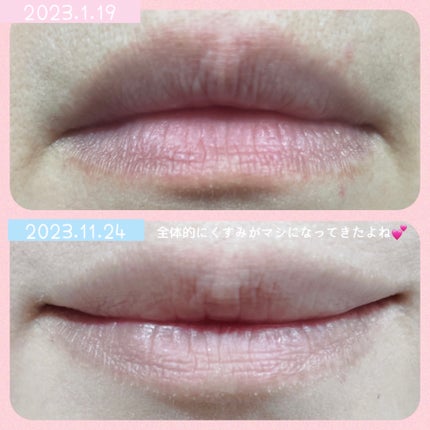 リップスリーピングマスク/LANEIGE/リップバームを使ったクチコミ(4枚目)