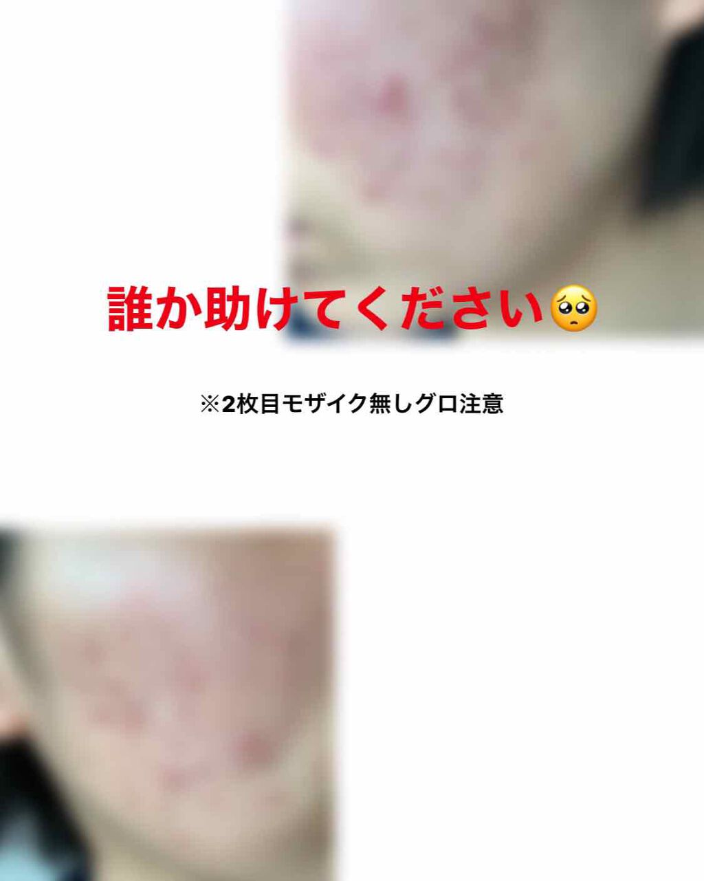 オードムーゲ 薬用ローション(ふきとり化粧水)/オードムーゲ/拭き取り化粧水を使ったクチコミ(1枚目)