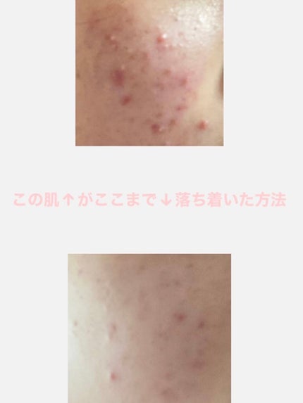 乳液・敏感肌用・高保湿タイプ/無印良品/乳液を使ったクチコミ(1枚目)