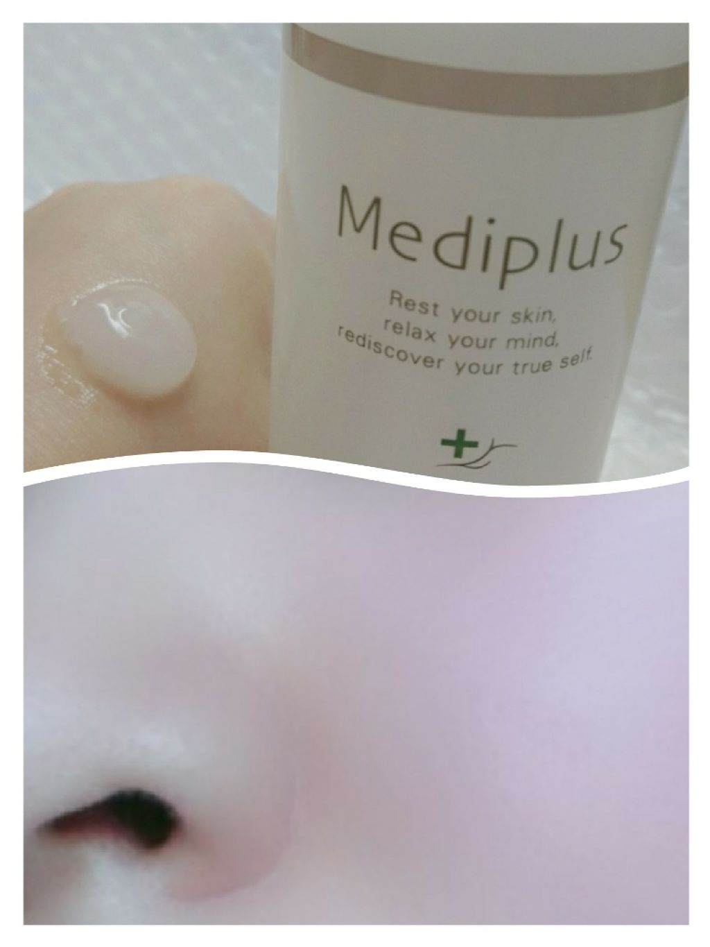 メディプラスゲル/メディプラス/オールインワン化粧品を使ったクチコミ(2枚目)