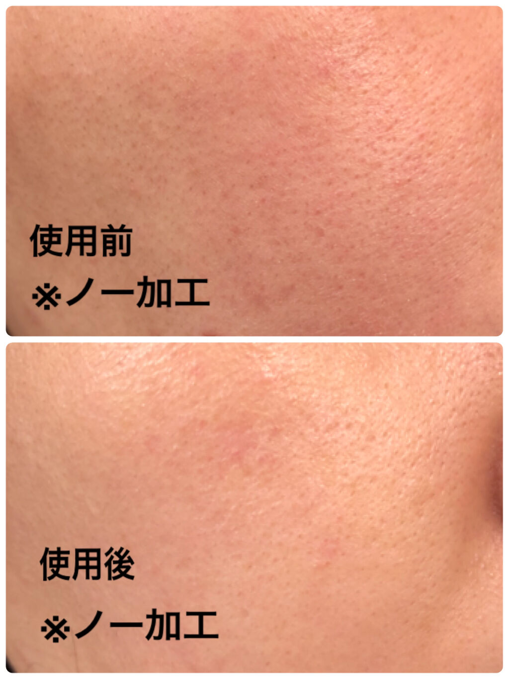 ティーツリーケア ソリューション エッセンシャルマスクEX/MEDIHEAL/シートマスク・パックを使ったクチコミ（3枚目）