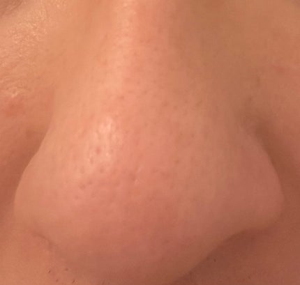 クレージュ クレンジングバーム クリアN/CLAYGE/クレンジングバームを使ったクチコミ(5枚目)