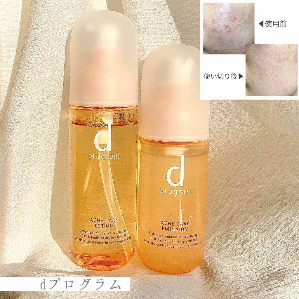dプログラム アクネケア ローション MB 120ml+エマルジョン(2+2) d プログラムのスキンケア・基礎化粧品 アクネケア エマルジョン R＆