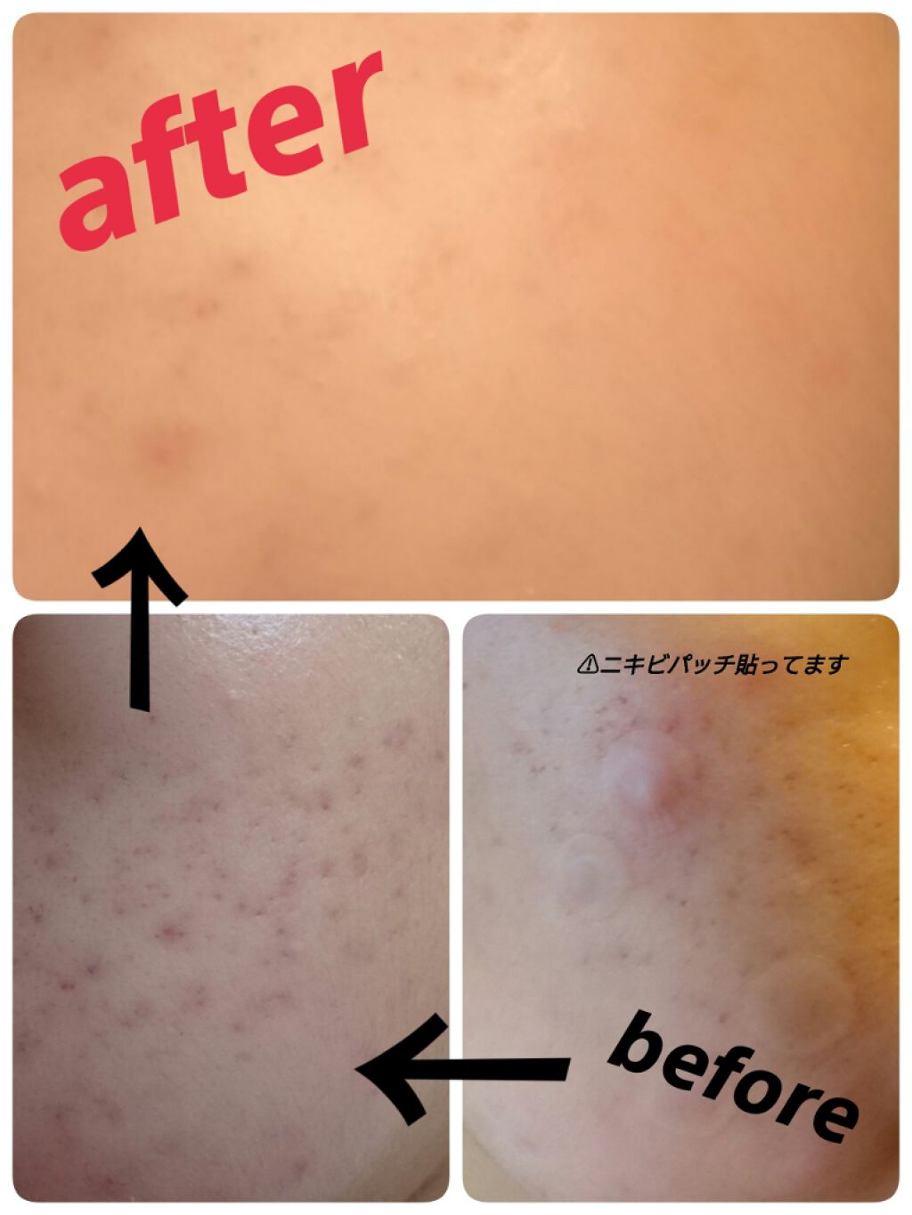 敏感肌用薬用美白美容液/無印良品/美容液を使ったクチコミ(2枚目)