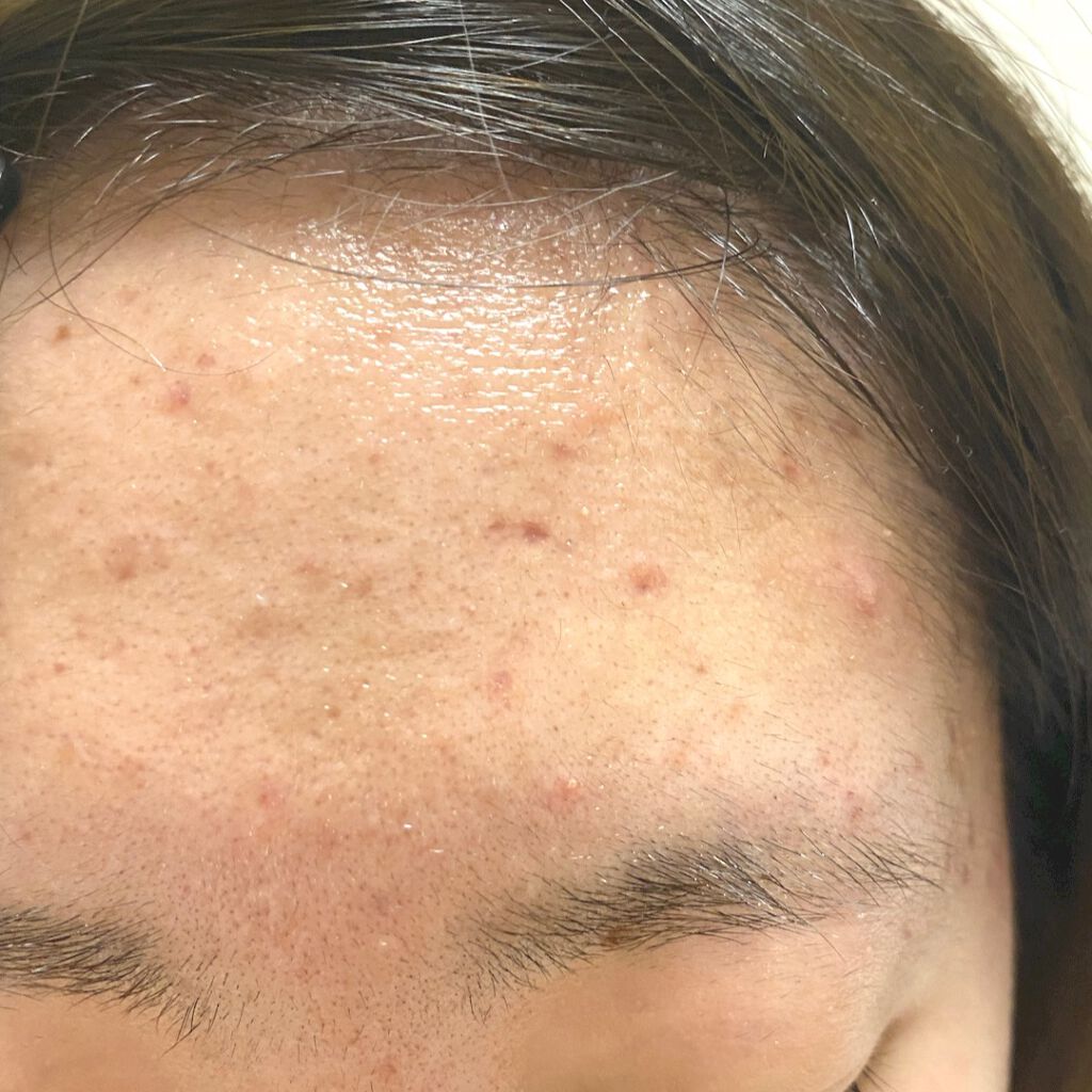 Mちゃん on LIPS 「⚠️閲覧大注意⚠️本当に汚いので苦手な方はご遠慮ください🙇♀..」(4枚目)