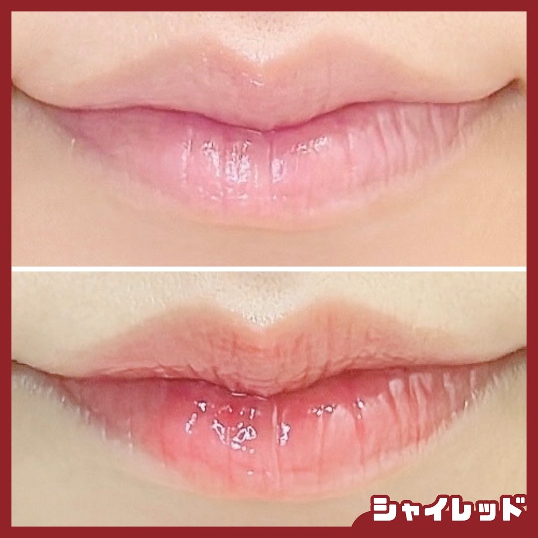 ユース ラディアンス ビタチノール セラム/primera/美容液を使ったクチコミ（3枚目）