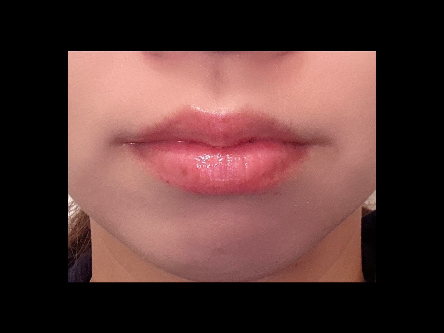 ニードルプランパー ほてりシアー/Ui2./リッププランパーを使ったクチコミ(2枚目)