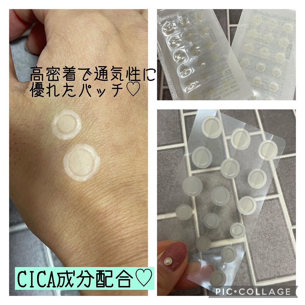 OK CICA CLEAR PATCH/GR/その他を使ったクチコミ(2枚目)