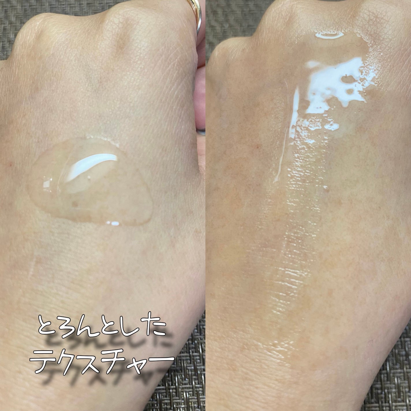 EXOPRO 美容液/ブレーンコスモス/美容液を使ったクチコミ(5枚目)