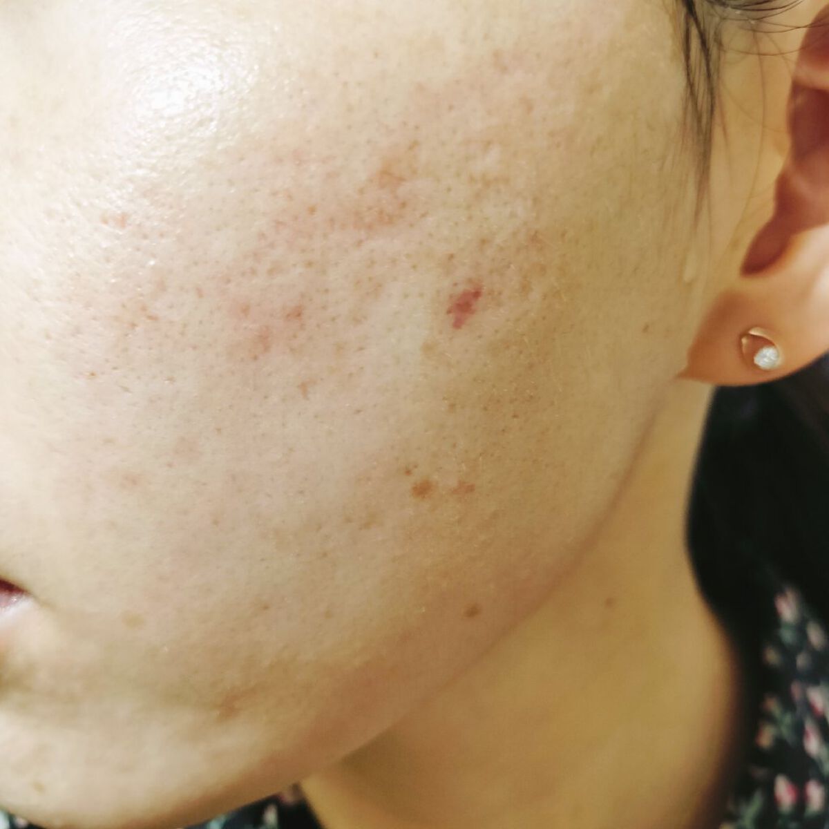 ナイアシンアミド美容液/InstaNatural/美容液を使ったクチコミ（2枚目）