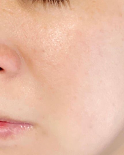 北海道産プロテオグリカン配合化粧水/北海道原液シリーズ /化粧水を使ったクチコミ(4枚目)