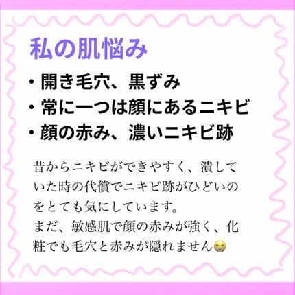 ダーマレーザースーパーVC100マスク/クオリティファースト/シートマスク・パックを使ったクチコミ(2枚目)