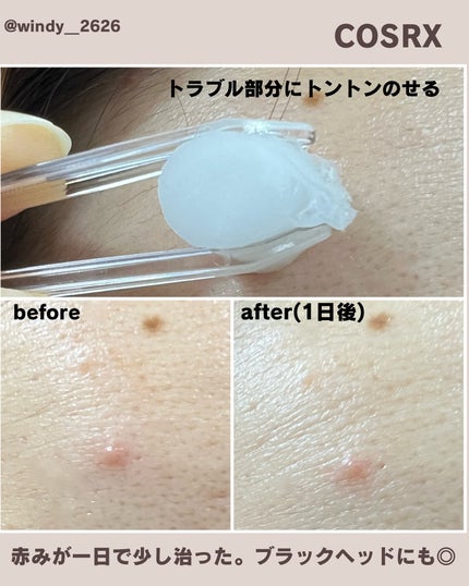 RXザ・AHA2 BHA2 ブラミッシュトリートメントセラムコットン/COSRX/美容液を使ったクチコミ(10枚目)