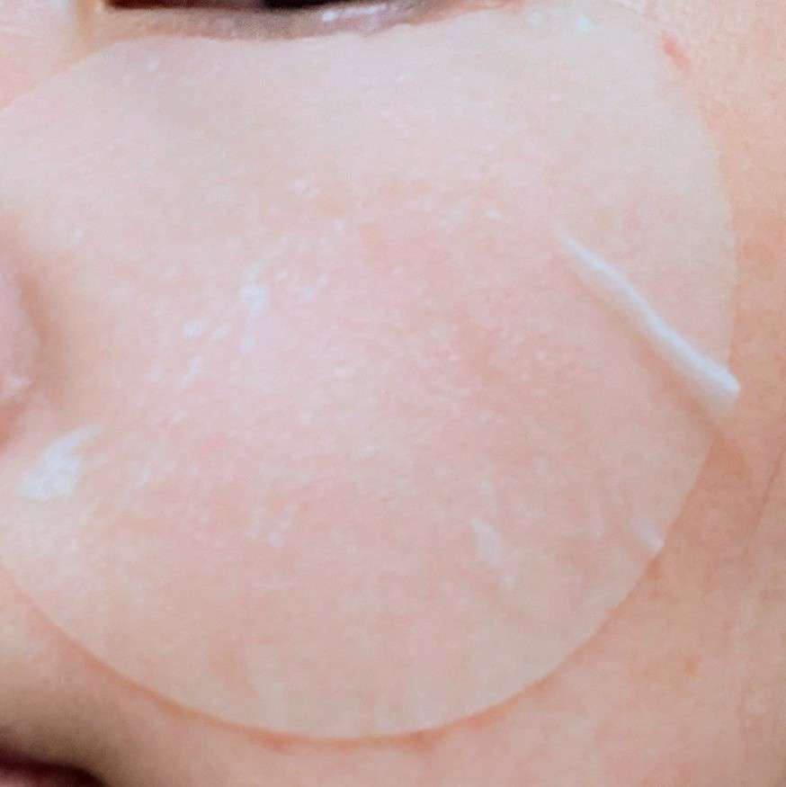 センテラ クイックカーミングパッド/SKIN1004/トナーパッドを使ったクチコミ(1枚目)