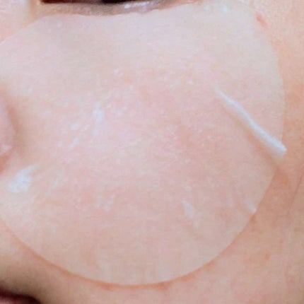 センテラ クイックカーミングパッド/SKIN1004/トナーパッドを使ったクチコミ(1枚目)