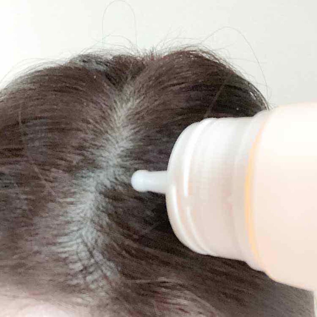 マイナチュレ 無添加育毛剤/マイナチュレ/頭皮ローションを使ったクチコミ(3枚目)