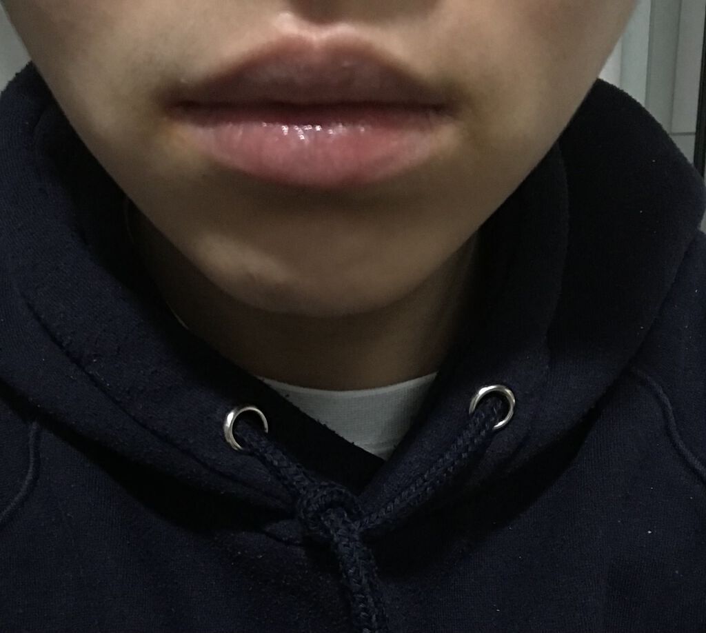 リップトリートメントバーム/LANEIGE/リップケアを使ったクチコミ（3枚目）