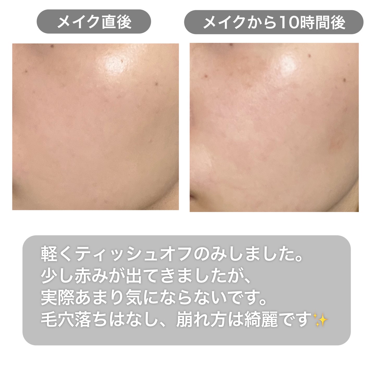 ライトリフレクティング ファンデーション/NARS/リキッドファンデーションを使ったクチコミ(3枚目)