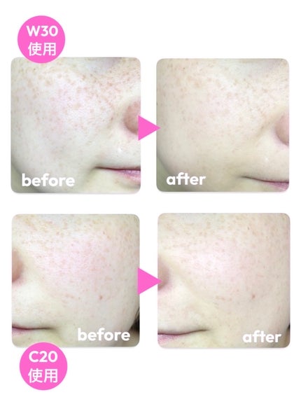 SPステイ ルミマット リキッド ファンデーション/MAYBELLINE NEW YORK/リキッドファンデーションを使ったクチコミ(10枚目)