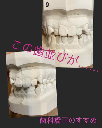 ãããð on LIPS ãæ¯ç§å»çåŸäºè
ã§ã(o^^o)ä»åã¯æ¯åç¯æ£ã«ã€ããŠã玹ä»ãã..ãïŒ1æç®ïŒ