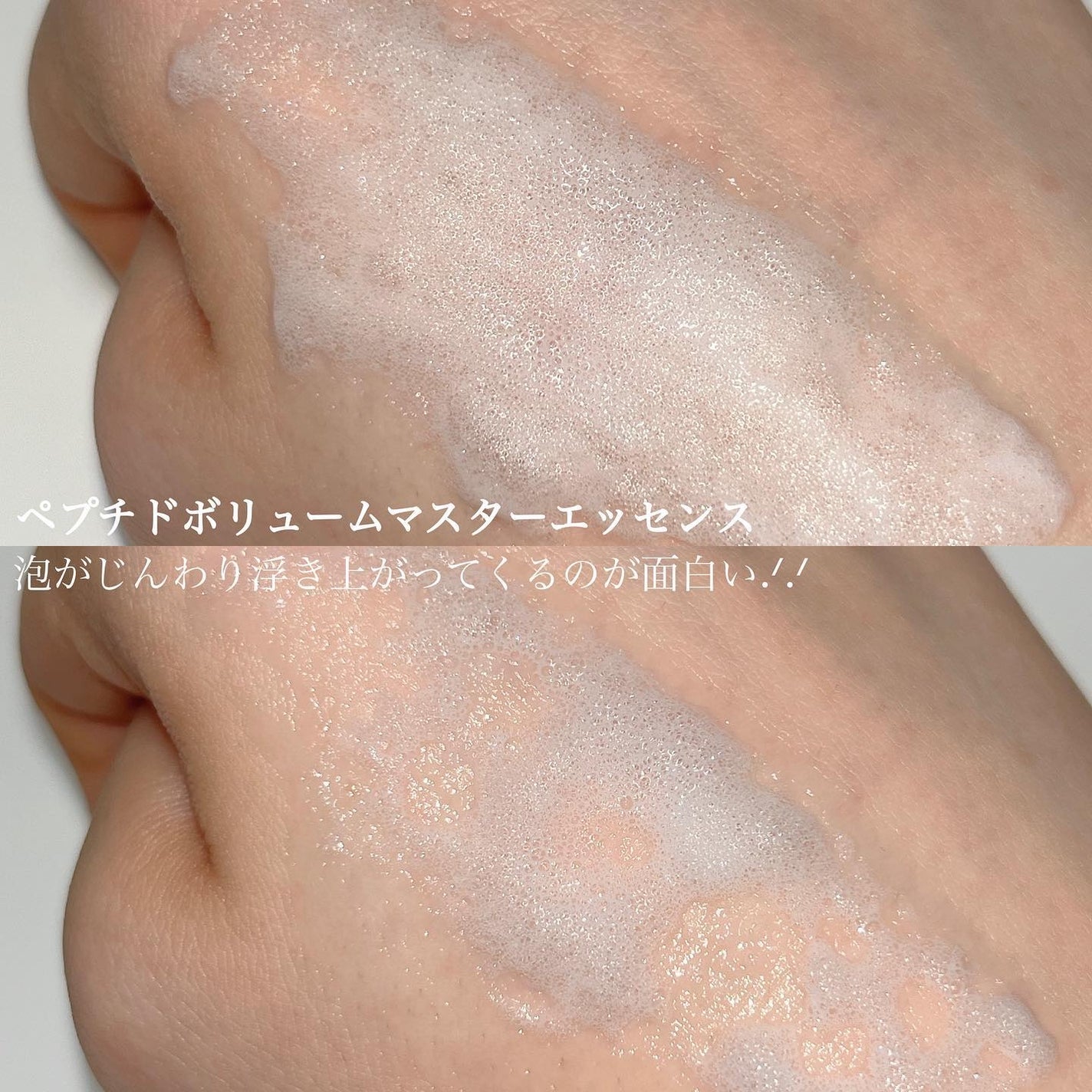 ペプチド ボリューム マスター エッセンス/DR.PEPTI/美容液を使ったクチコミ(3枚目)