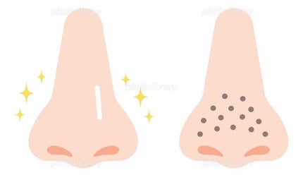 ドットウォッシー洗顔石鹸(旧)/ペリカン石鹸/洗顔石鹸を使ったクチコミ(2枚目)