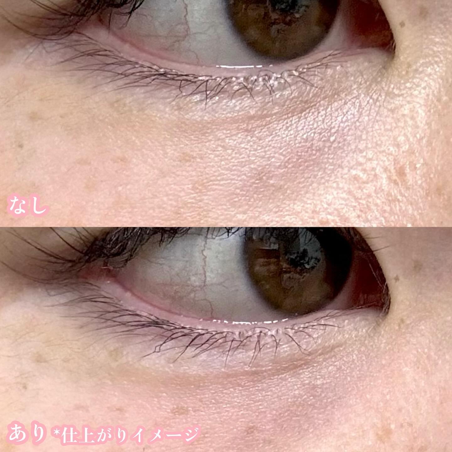 リンクル ダブル リペア/ONE BY KOSE/美容液を使ったクチコミ（3枚目）