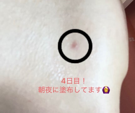 ã²ãŒð¶ð§¡ on LIPS ãâãªã«ãã¹ã®ã¯ãªã¢ã¢ã¯ãã¹ãããâããããå¹ãåºç©ã«å¡ããšå³å¹..ãïŒ5æç®ïŒ