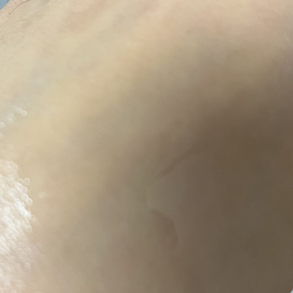 ガラクトミセスピュアビタミンCグロートナー/SOME BY MI/化粧水を使ったクチコミ（2枚目）