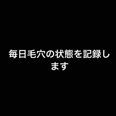 今日も同じスキンケアをしました。
まだ精製水は買えてないので試してはいません。
あまり変わった感じは自分ではわからないし
1日では変わらないと思うので
これからも頑張ります！
精製水買ったらまたスキンケ