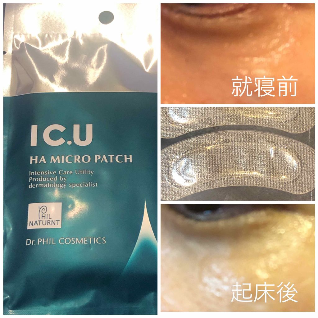 ｉマイクロパッチ/Spa treatment/シートマスク・パックを使ったクチコミ（2枚目）