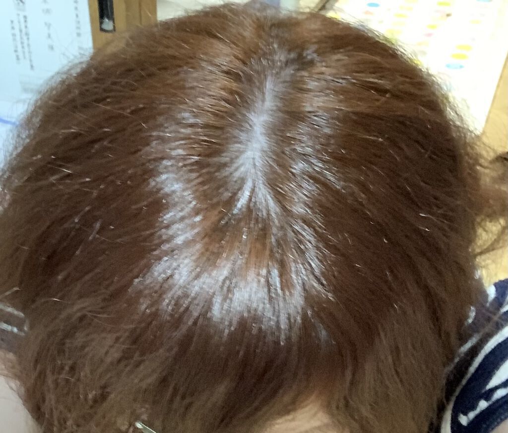 カラージェニック ミルキーヘアカラー (ちらっと白髪用) OP02 ジンジャーオレンジ/サイオス/ヘアカラーを使ったクチコミ（1枚目）