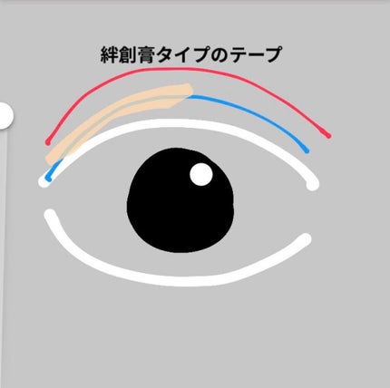 二重まぶた用シール/DAISO/二重まぶた用アイテムを使ったクチコミ(4枚目)