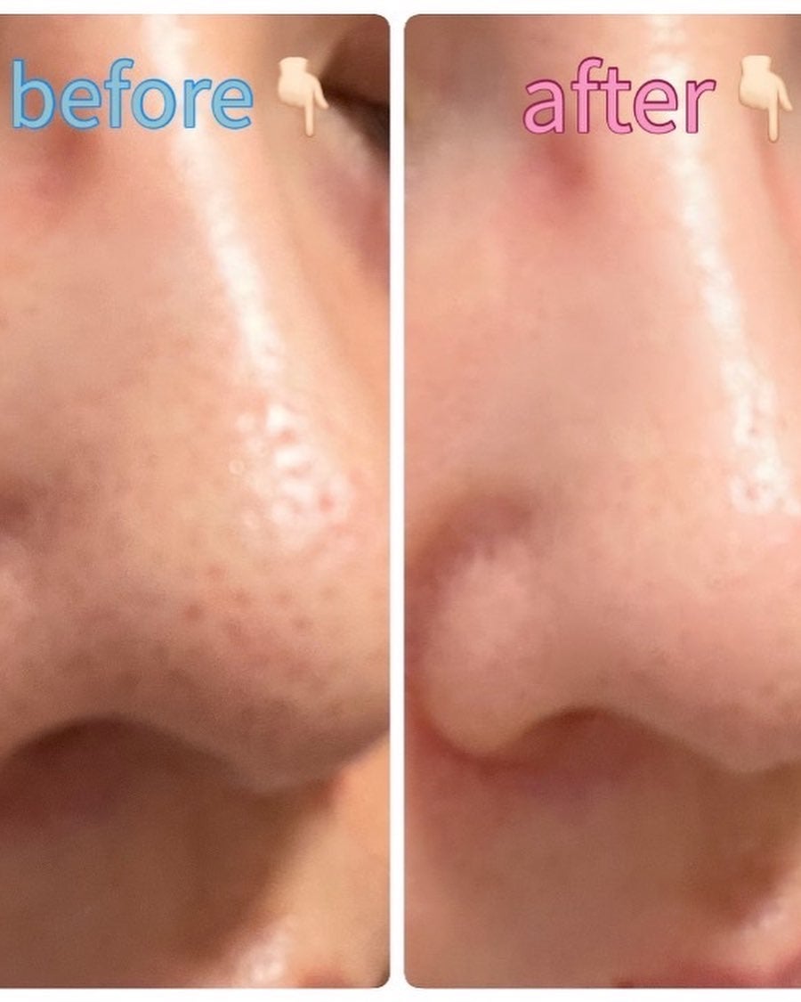 ゼロ毛穴パッド 2.0/MEDICUBE/トナーパッドを使ったクチコミ(4枚目)