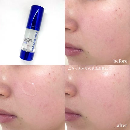 ピトピディーアールエヌ カプセルショット アンプル/One-day's you/美容液を使ったクチコミ(4枚目)