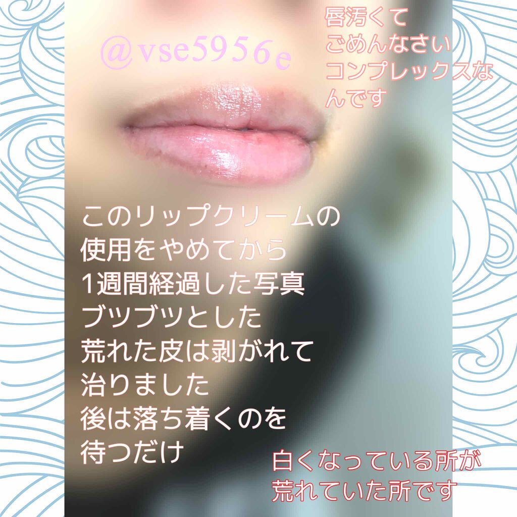 薬用リップクリーム Dhcの辛口レビュー シンプルに塗ってみた感想を簡潔に By アバンドバン E 乾燥肌 代後半 Lips 薬用リップクリーム Dhcの辛口レビュー シンプルに塗ってみた感想を簡潔に By アバンドバン E 乾燥肌 代後半 Lips