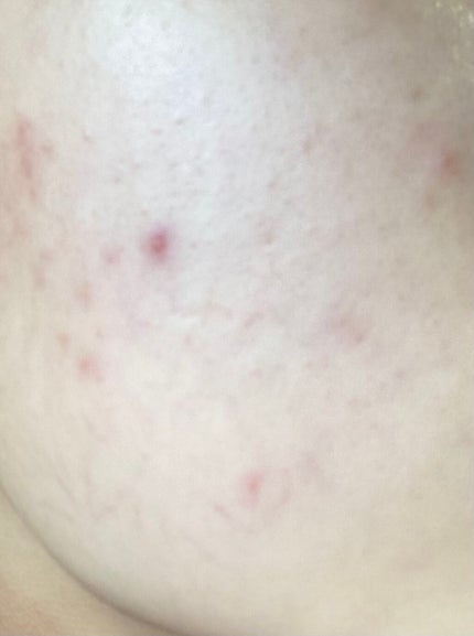 ãã¹ã¯ãã£ãããªãŒã«ã«ããŒã¯ãã·ã§ã³/TIRTIR(ãã£ã«ãã£ã«)/ã¯ãã·ã§ã³ãã¡ã³ããŒã·ã§ã³ã䜿ã£ãã¯ãã³ãïŒ4æç®ïŒ