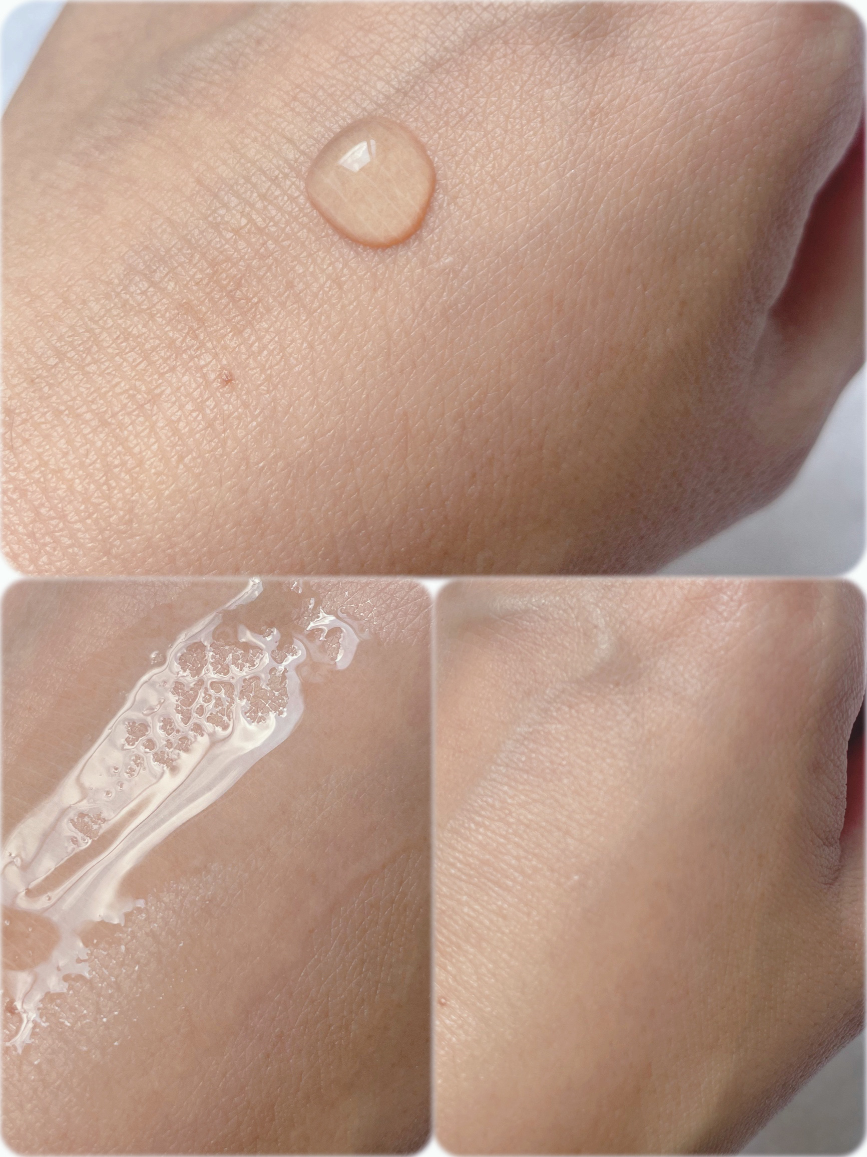 ファイン100/imini/美容液を使ったクチコミ（2枚目）