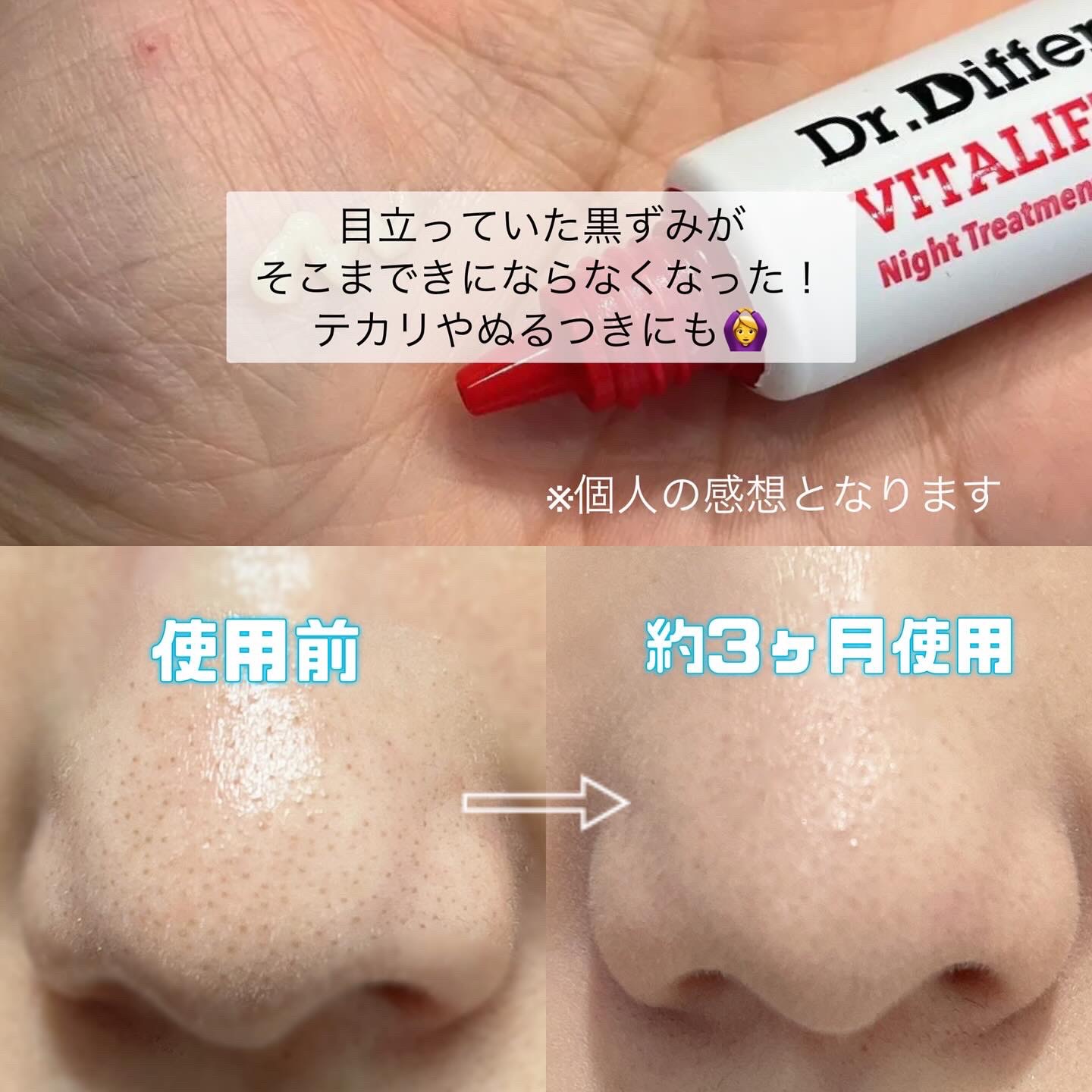 VITALIFT A/Dr.Different/フェイスクリームを使ったクチコミ（3枚目）