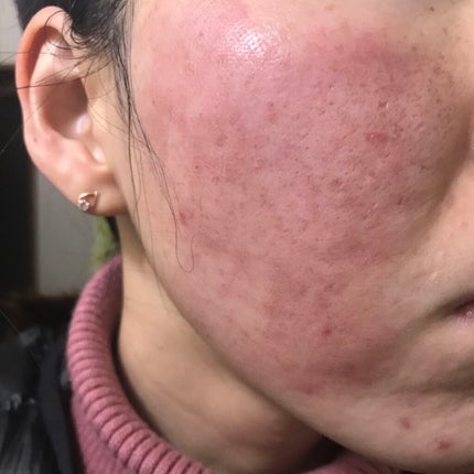 ナチュラル チークN/CEZANNE/パウダーチークを使ったクチコミ(6枚目)